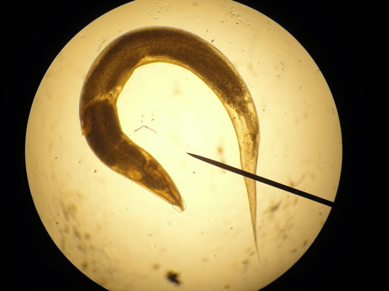 enterobius_vermicularis_pin_worm1349633792388