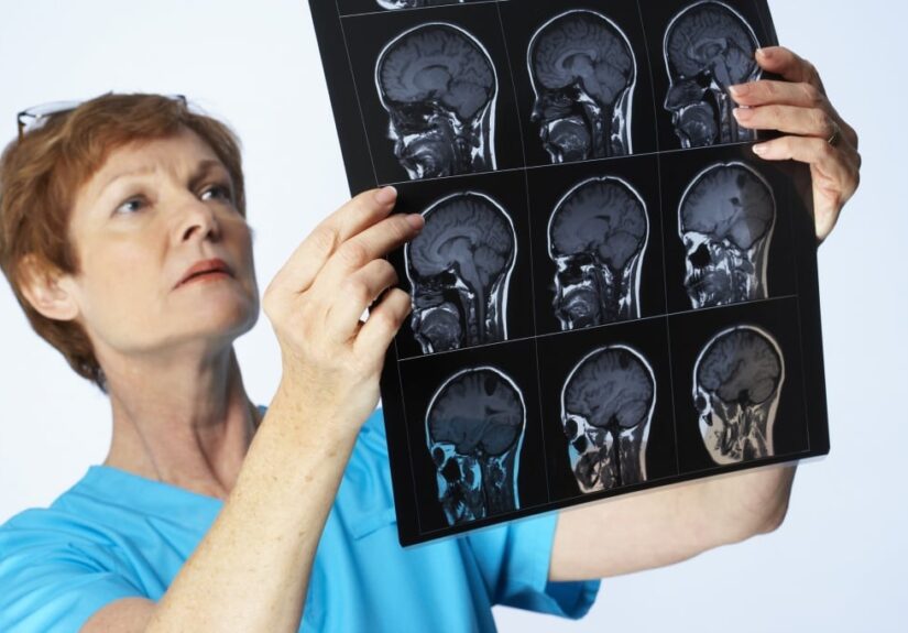 55780e788b2f54eeec8ebce66b7233af